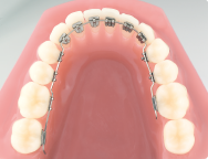 Lingual Orthodontic Courses